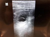 Am 25. Tag waren mindestens 5 Welpen im Ultraschall zu sehen